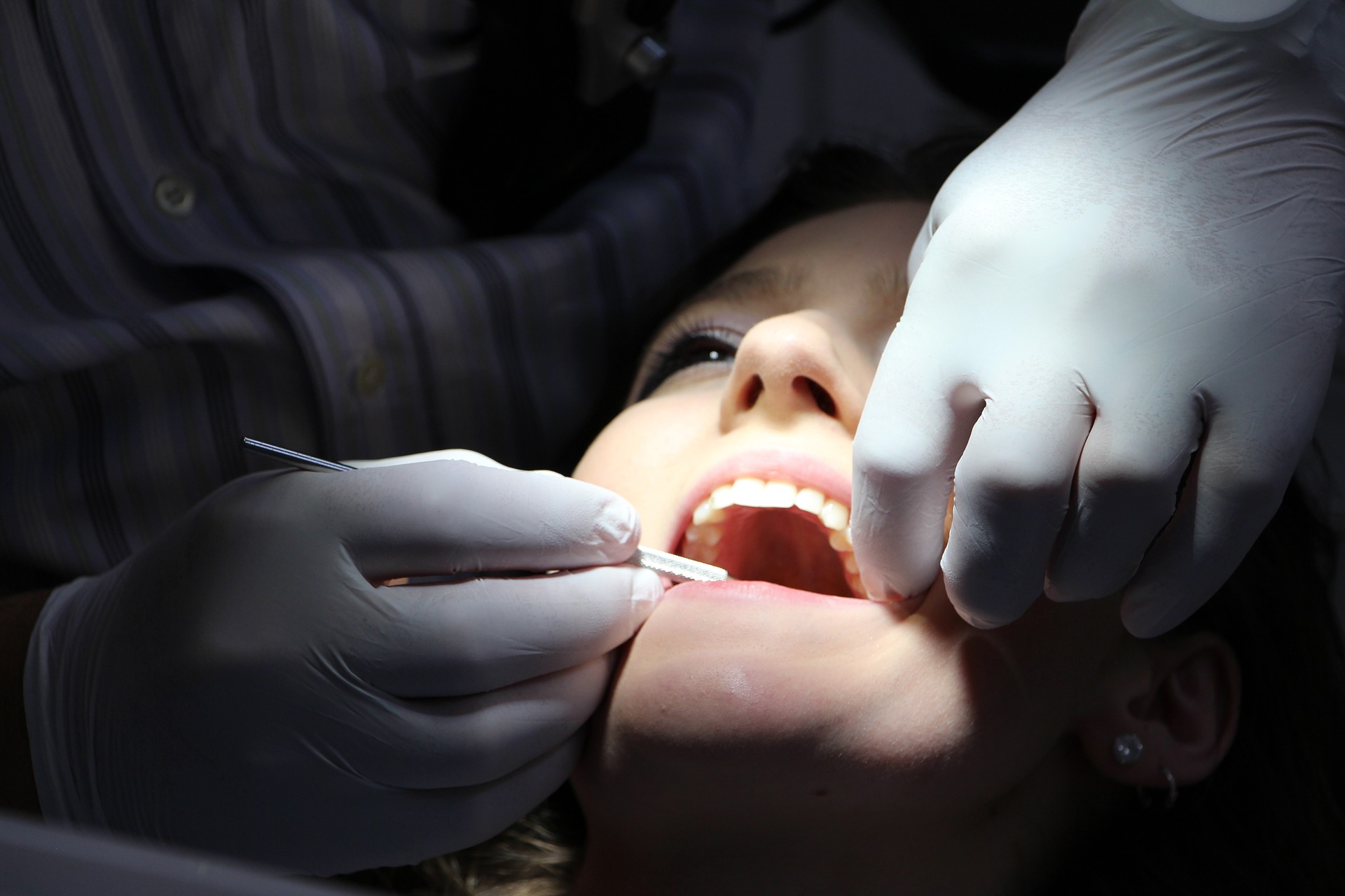 Dentální hygiena – ošetření